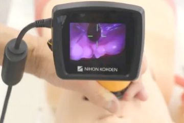 ビデオ硬性咽頭鏡